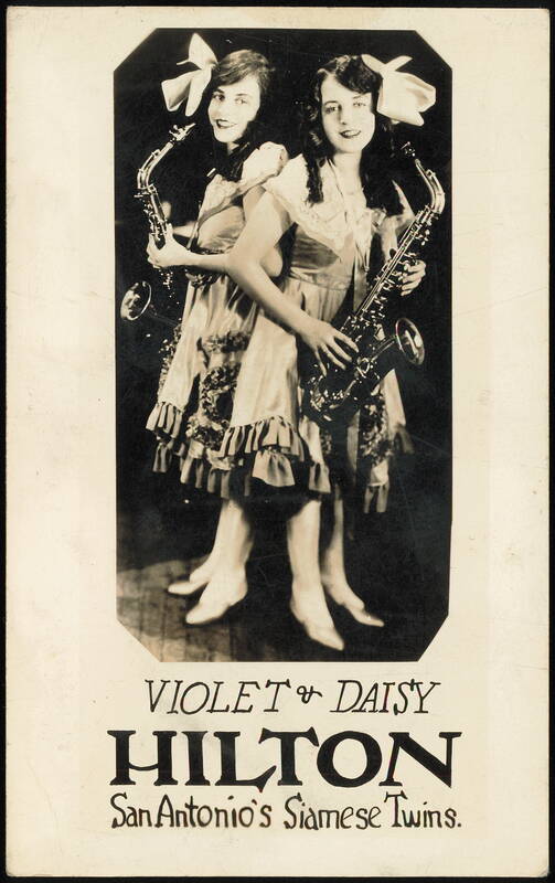 Violet and Daisy Hilton, San Antonio's Siamese Twins Texas
