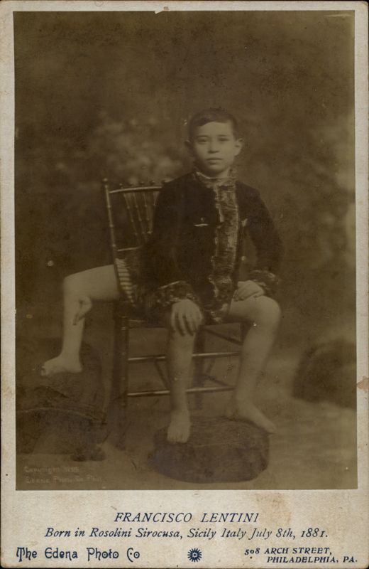 Francisco (Frank) Lentini, Three-Legged Boy Circus Sideshow Philadelphia Pennsylvania