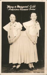 Mary & Margaret Gibb American Siamese Twins Conjoined Sisters Postcard