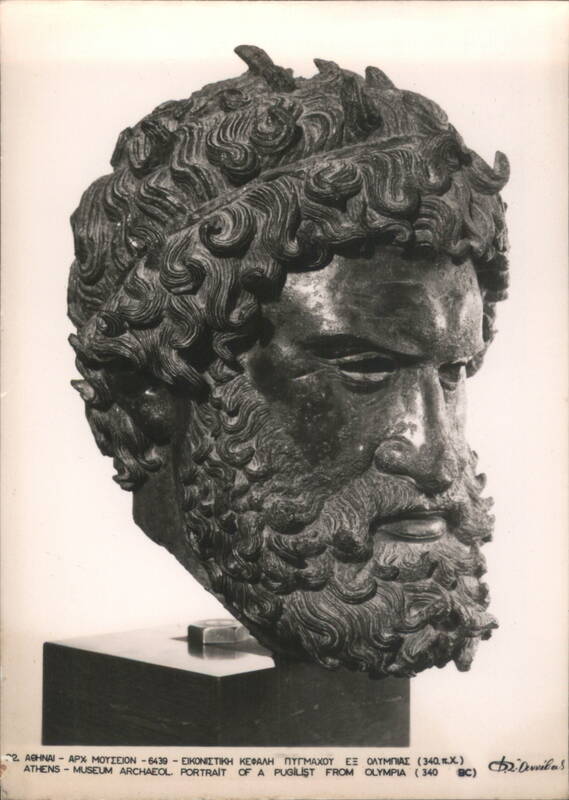 Portrait of a Pugilist from Olympia, Athens Museum Greece