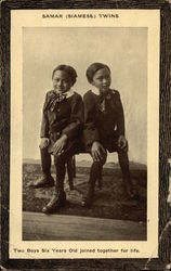 Samar (Siamese) Twins Postcard Postcard