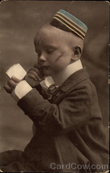 A Boy with a Scar on his Face Boys