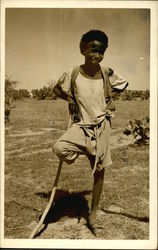 Amputee, Native of Sudan Postcard