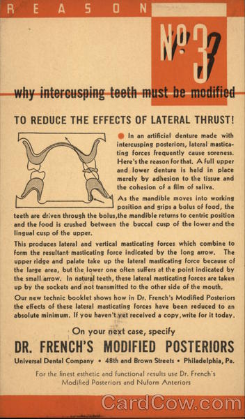 Why Intercusping Teeth Must Be Modified Advertising