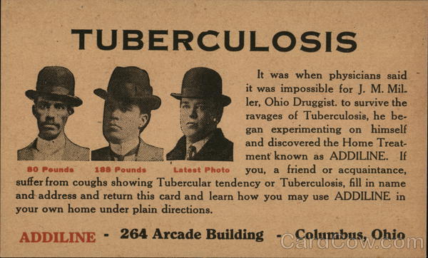 Addiline Tuberculosis Treatment Columbus Ohio Advertising
