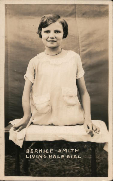 Sideshow: Bernice Smith Living Half Girl Circus