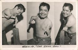 Sealo - The Seal Boy Sideshow Small Arms/Hands Postcard