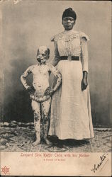 Sideshow: Leopard Skin Kaffir Child with his Mother A Freak of Nature Postcard