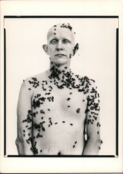Man Covered With Swarm Of Bees Postcard