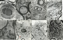 Lot of 8 Photographs: Electron Microscopy University College London Original Photograph
