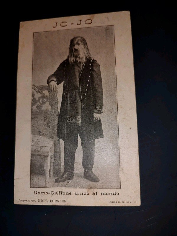 Jojo the Dog Faced Boy, Fedor Jeftichew (1868-1904).